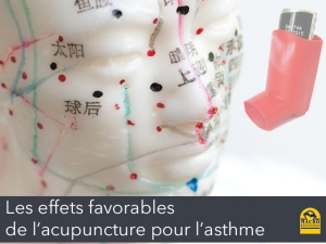 Acupuncture et asthme/allergies